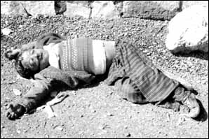 Slachtoffer van de gifgasaanval in Halabja
