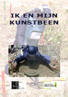 kunstbeen